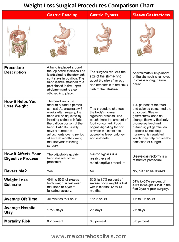 Sleeve Gastrectomy Weight Loss Chart